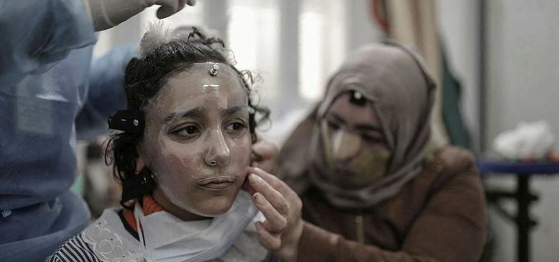 GAZA GIRL DONS 3D-PRINTED MASK TO HEAL BURNT FACE