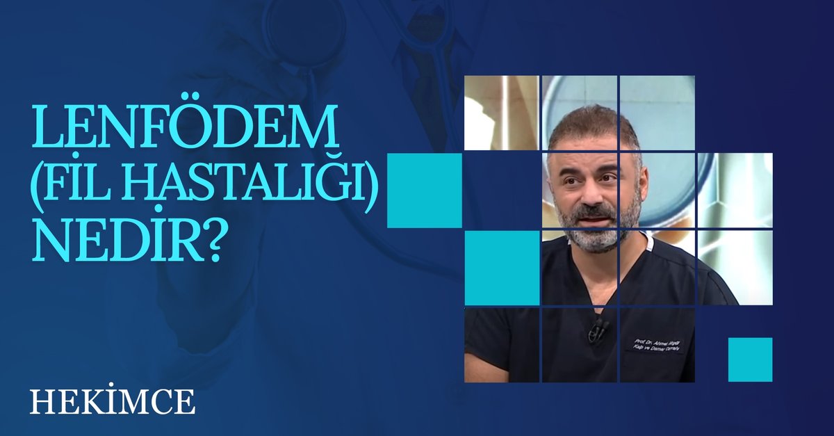 Lenfödem Fil Hastalığı Nedir? | Hekimce