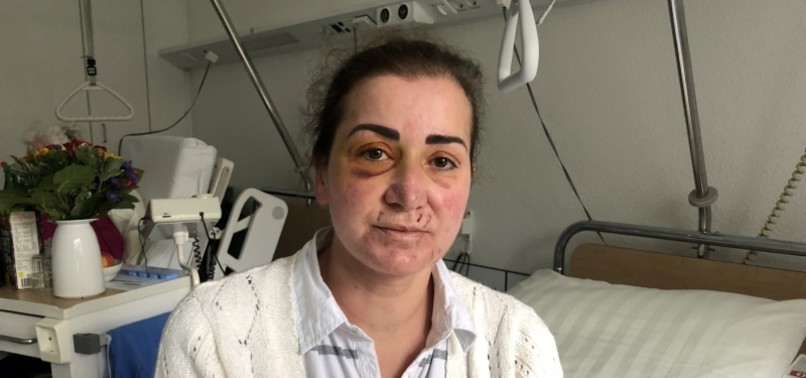 TURKISH WOMAN SEEKS JUSTICE FOR ASSAULT ON TRAM IN GERMANY