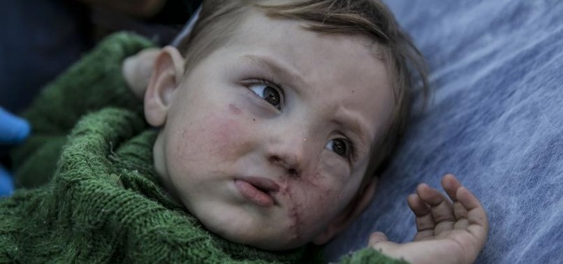 SYRIAN BABY WITH FACIAL WOUNDS GETS TREATMENT IN TURKEY