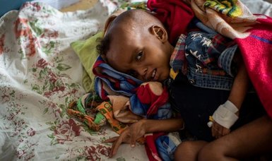 UN warns severe child malnutrition has been increasing in Tigray region