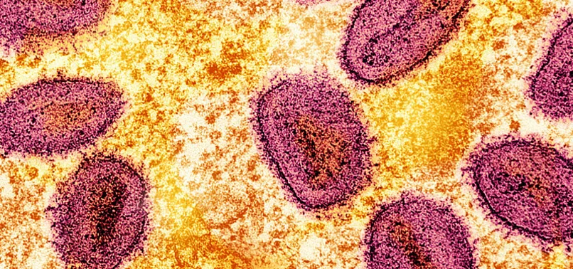 Acselode Ugandas mpox caseload rises to double-digit, health official says