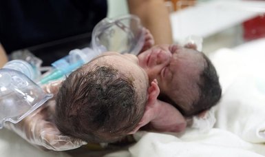 Turkey reunites Syrian conjoined twins with mother after 101 days