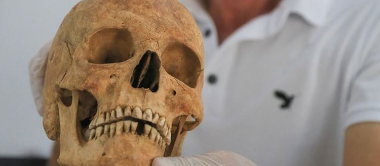 Euromos’ta ’2 bin 200 yıllık beyin ameliyatı’ izleri
