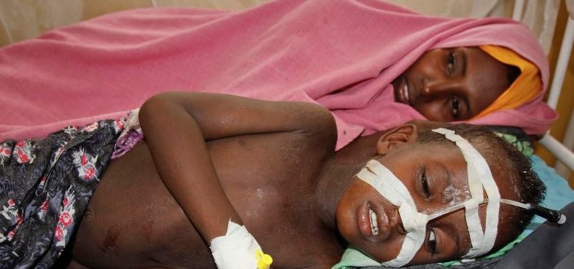 19 CHILDREN DIE FROM SUSPECTED MEASLES OUTBREAK IN NORTHEASTERN NIGERIA