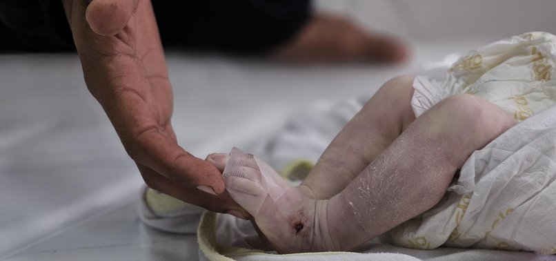 27-DAY-OLD BABY DIES FROM COLD IN GAZA