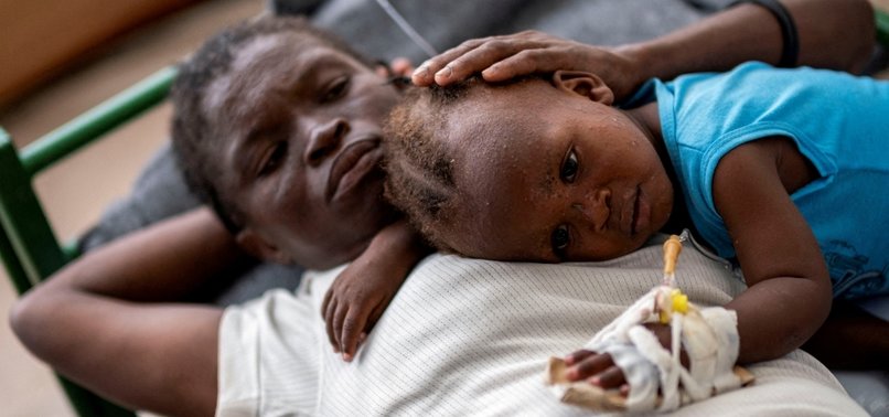 MALNOURISHED CHILDREN AT RISK IN MALAWI CHOLERA CRISIS: UN