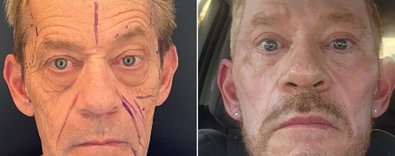 Estetikpazarındaerkekdevrimi