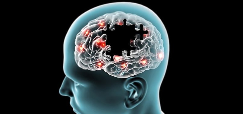 UNPRECEDENTED CASE: 19-YEAR-OLD DIAGNOSED WITH ALZHEIMER DISEASE, SETS GLOBAL RECORD