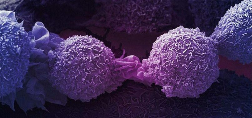 NEW DISCOVERY BY US RESEARCHERS COULD BE THE ‘ACHILLES’ HEEL’ OF MULTIPLE CANCERS