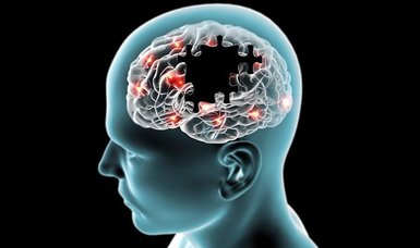 Where in the brain is the cause of Alzheimer's?