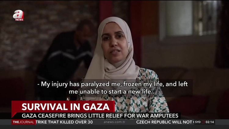 Ceasefire brings little relief for thousands of Gaza war amputees