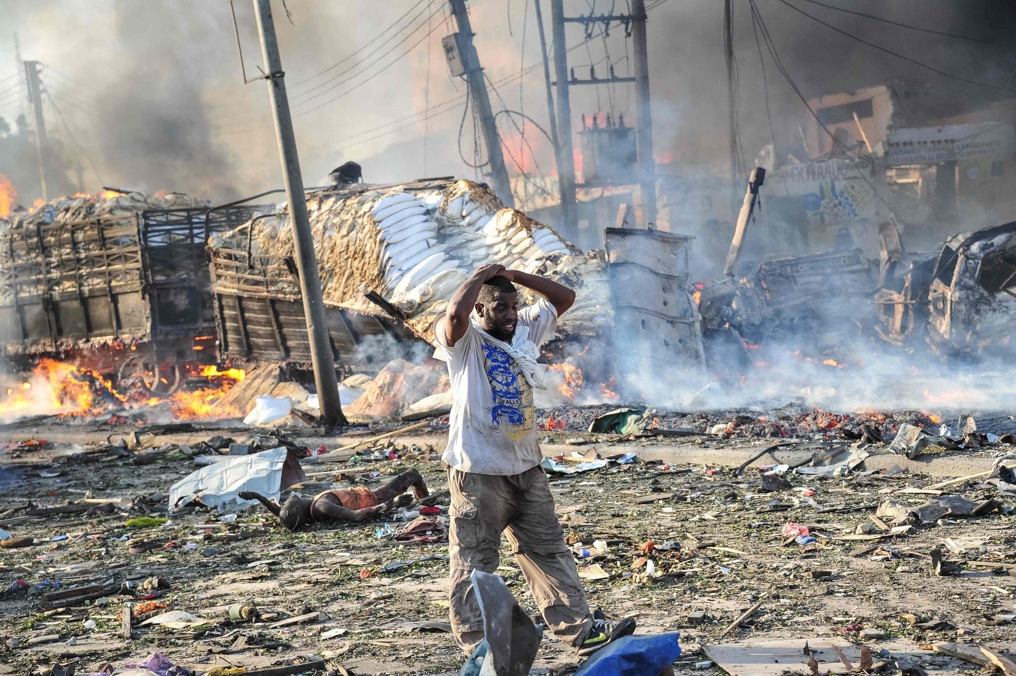 Somali’de ölü sayısı 189’a yükseldi