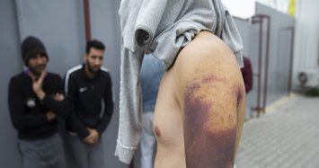 Pakistani migrant recounts how Greek soldiers tortured them