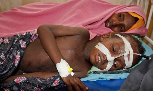 19 children die from suspected measles outbreak in Nigeria