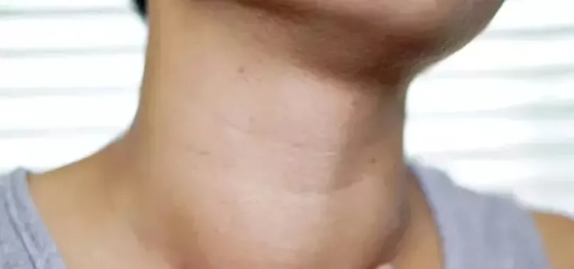 Tr Neck. Sign Neck size: An overlooked sign of health risks