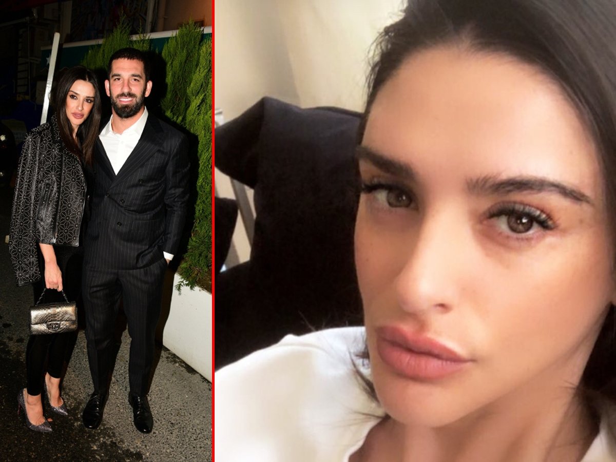aslihan dogan turan in dolgu sonrasi