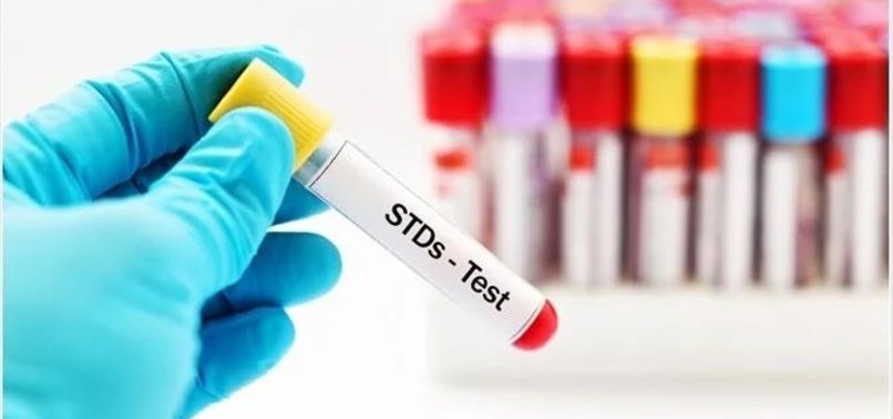 SEXUALLY TRANSMITTED INFECTIONS SURGE ACROSS EUROPE - LATEST DATA