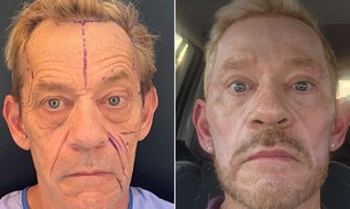 Estetik pazarında erkek devrimi