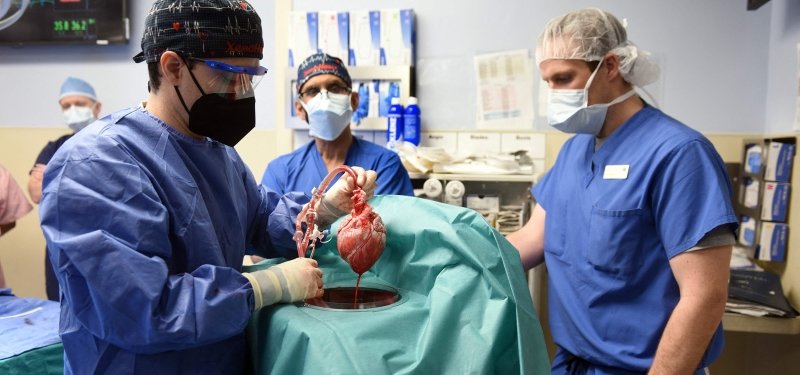 U.S. man to have transplant of genetically modified pig's heart dies