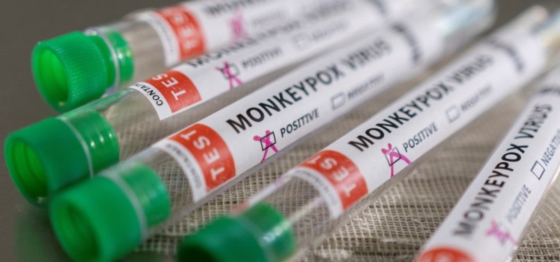 BAHRAIN REPORTS 1ST CASE OF MONKEYPOX