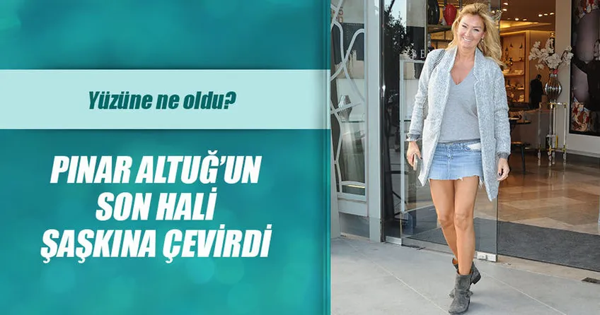 Pınar Altuğ’un yüzüne ne oldu?