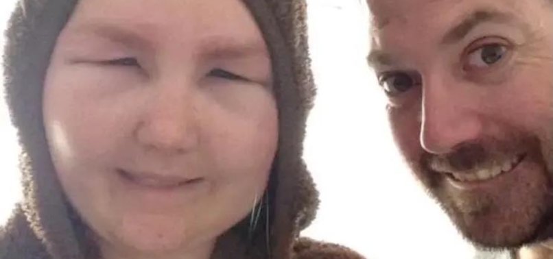 SWOLLEN AND DISFIGURED FACE OF WOMAN MAKES HER LOOK LIKE AN ALIEN AFTER BEAUTY TREATMENT GOES WRONG