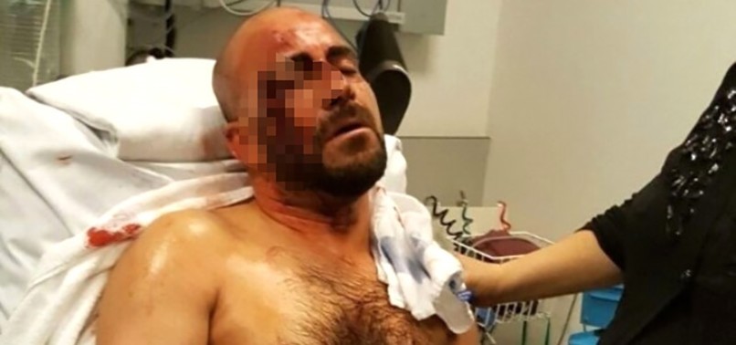 TURKISH MAN SEVERELY BEATEN BY FAR-RIGHT GROUP IN BELGIUM