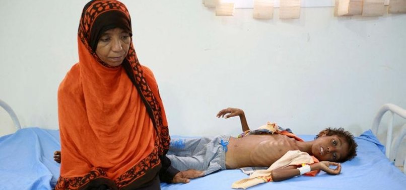 FAMINE PUSHES WAR-WEARY YEMENIS TO COMMIT SUICIDE