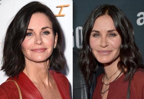 Courteney Cox'tan estetik itirafı - HarpersBazaar