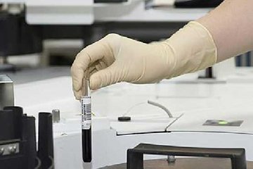 2018’de 9,6 milyon kişi kanserden öldü