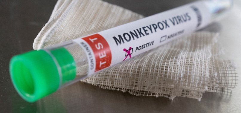 ARGENTINA RECORDS FIRST MPOX DEATH