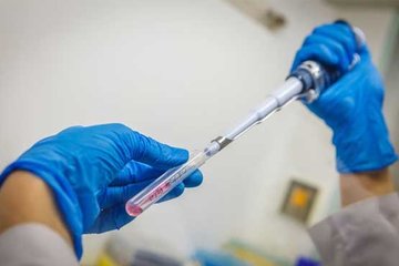 Akciğer kanserini Küba aşısıyla yendi