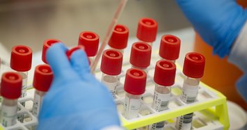 Testing blunders crippled US response as coronavirus spread