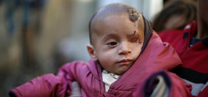 TURKISH AID AGENCY REACHES SYRIAN BABY KARIM