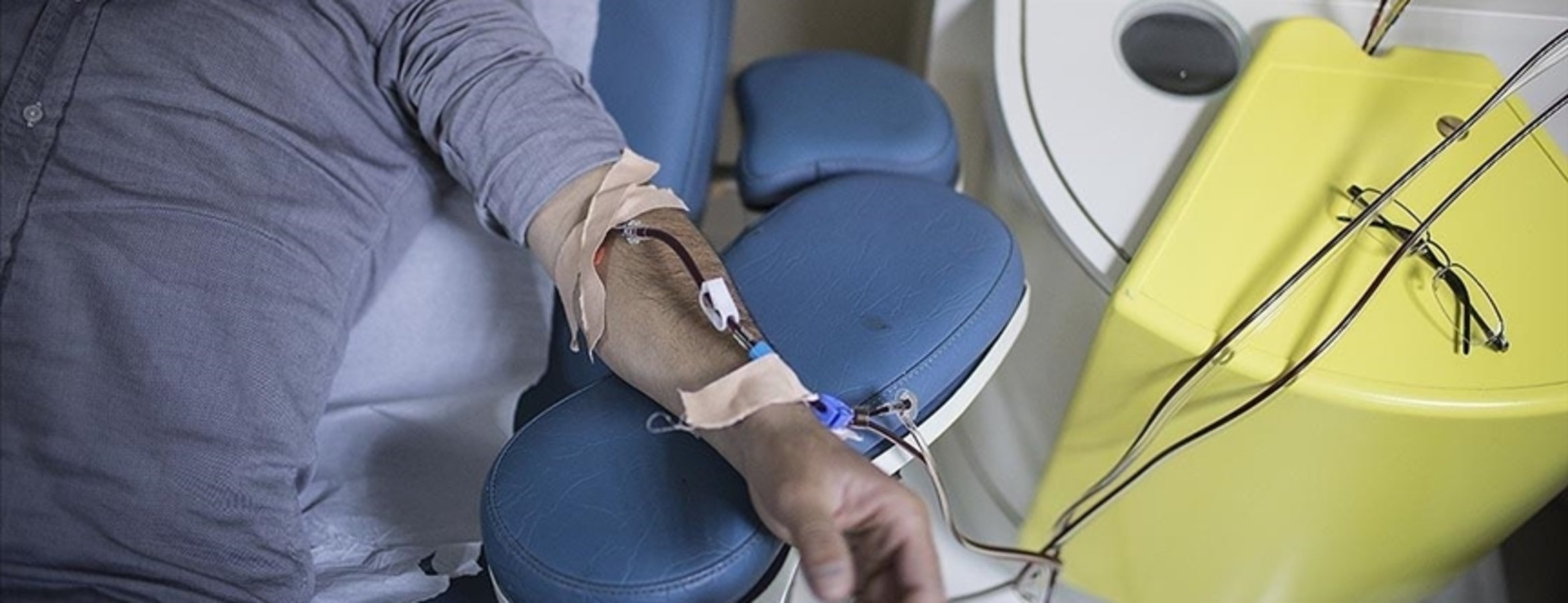 Türkiye’de her 6-7 erişkinden birinde çeşitli evrelerde kronik böbrek rahatsızlığı görülüyor