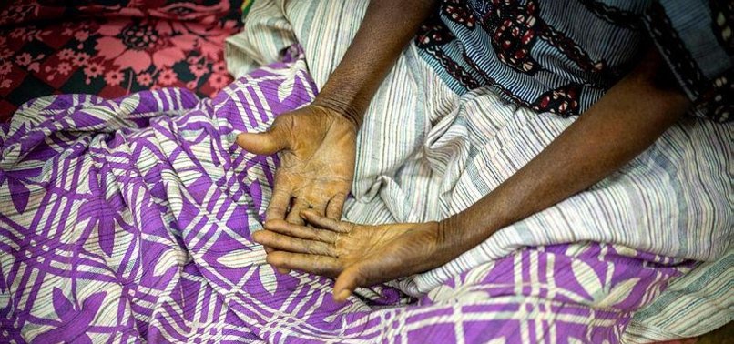 MORE THAN 24,000 PEOPLE IN GAMBIA LIVING WITH HIV