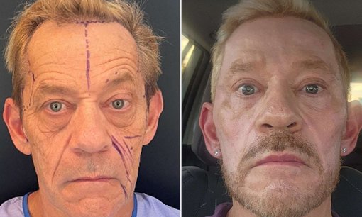 Estetik pazarında erkek devrimi