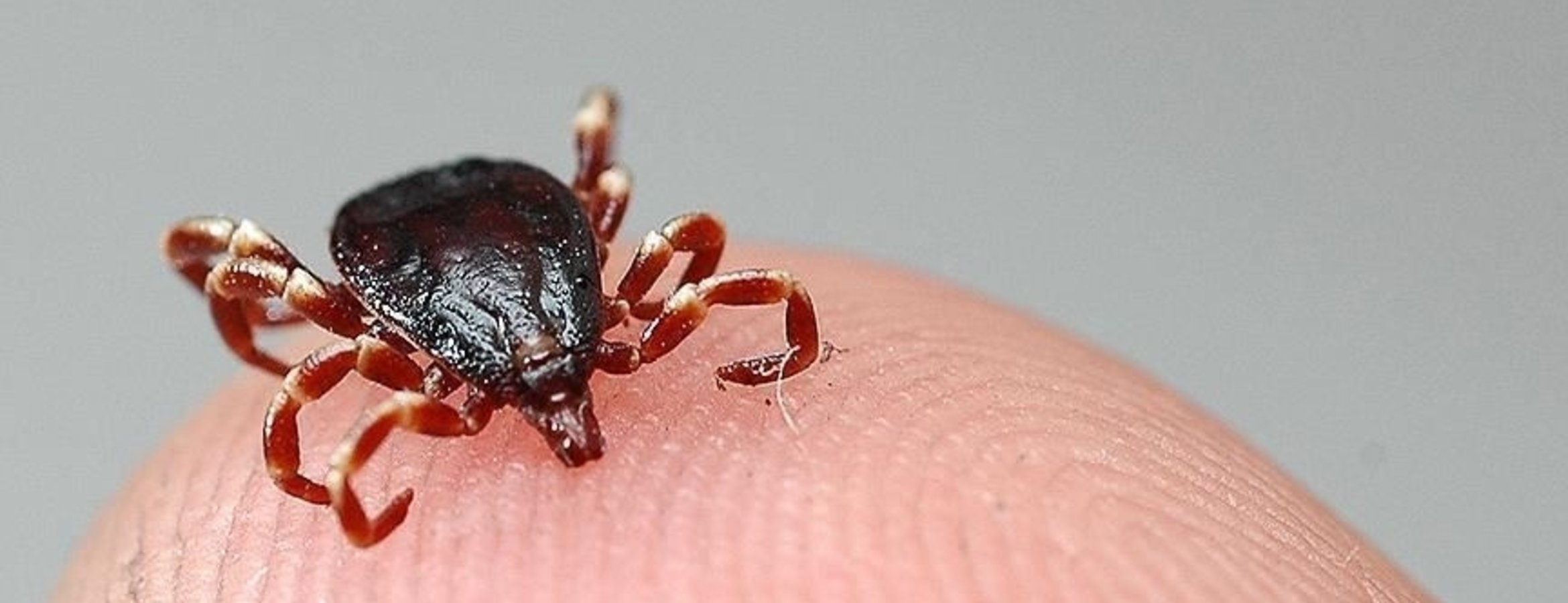Sivas’ta KKKA tanısı konulan 8 kişiden 1’i hayatını kaybetti