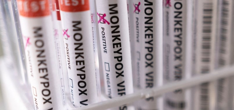 UK RECORDS 37 MORE CASES OF MONKEYPOX