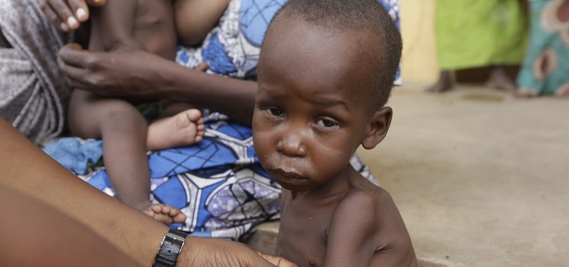 CHILD MALNUTRITION WORSENED IN INSURGENCY-HIT NIGERIA