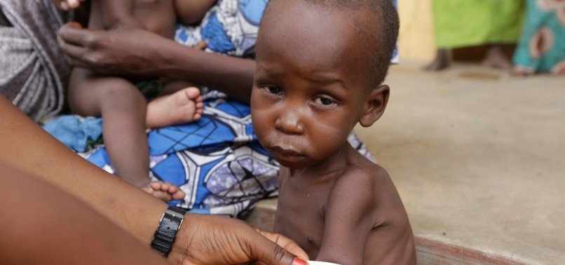 PNEUMONIA KILLS OVER 140,000 NIGERIAN KIDS EVERY YEAR
