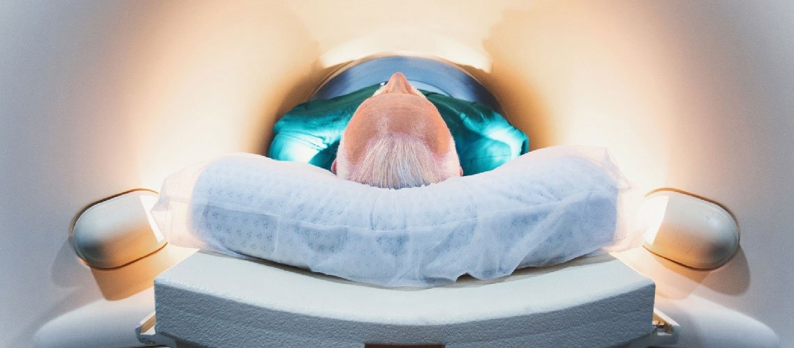 SİGARA SADECE AKCİĞER KANSERİ RİSKİNİ ARTIRIR