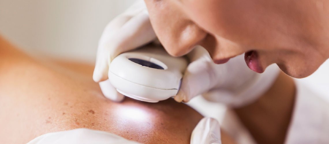 KANSER TEDAVİSİNDE ALTERNATİF TIP YETERLİDİR