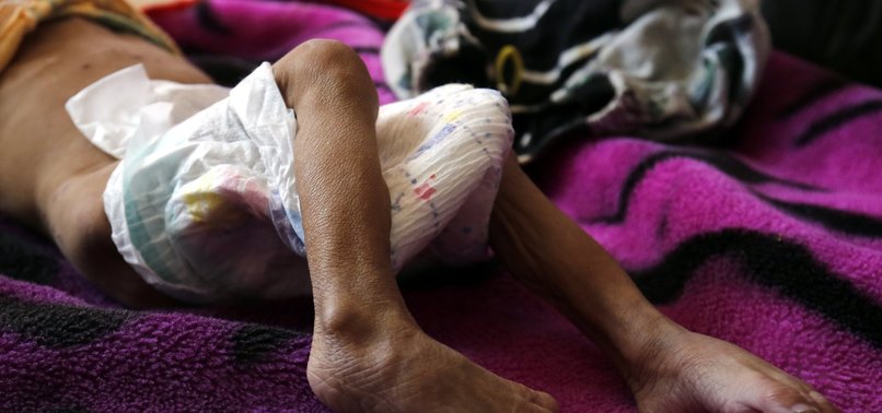 UN BODY PLANS TO DELIVER AID TO 14M YEMENIS PER MONTH