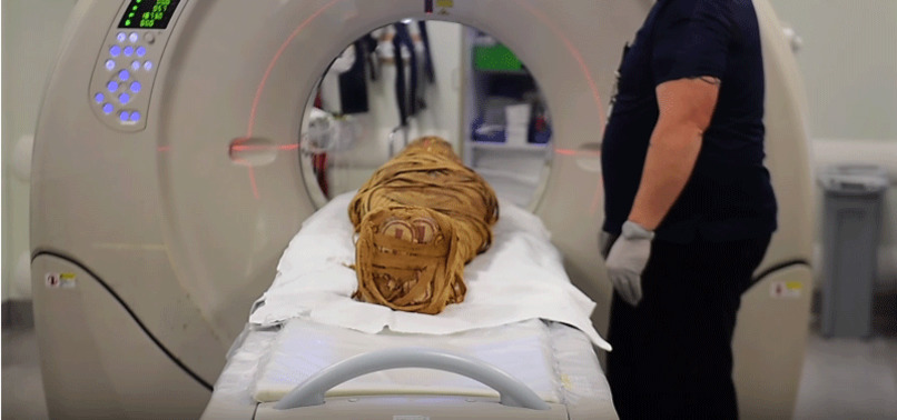 2,000-YEAR-OLD EGYPTIAN MUMMY DIAGNOSED WITH CANCEROUS TUMOR