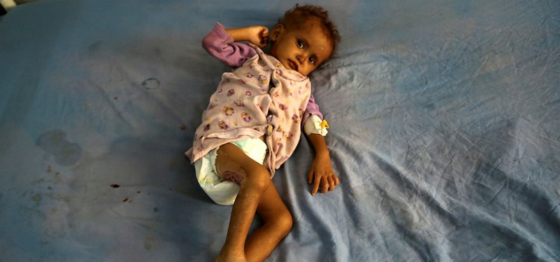 MORE THAN 7 MILLION YEMENI CHILDREN FACE SERIOUS FAMINE THREAT, UN WARNS