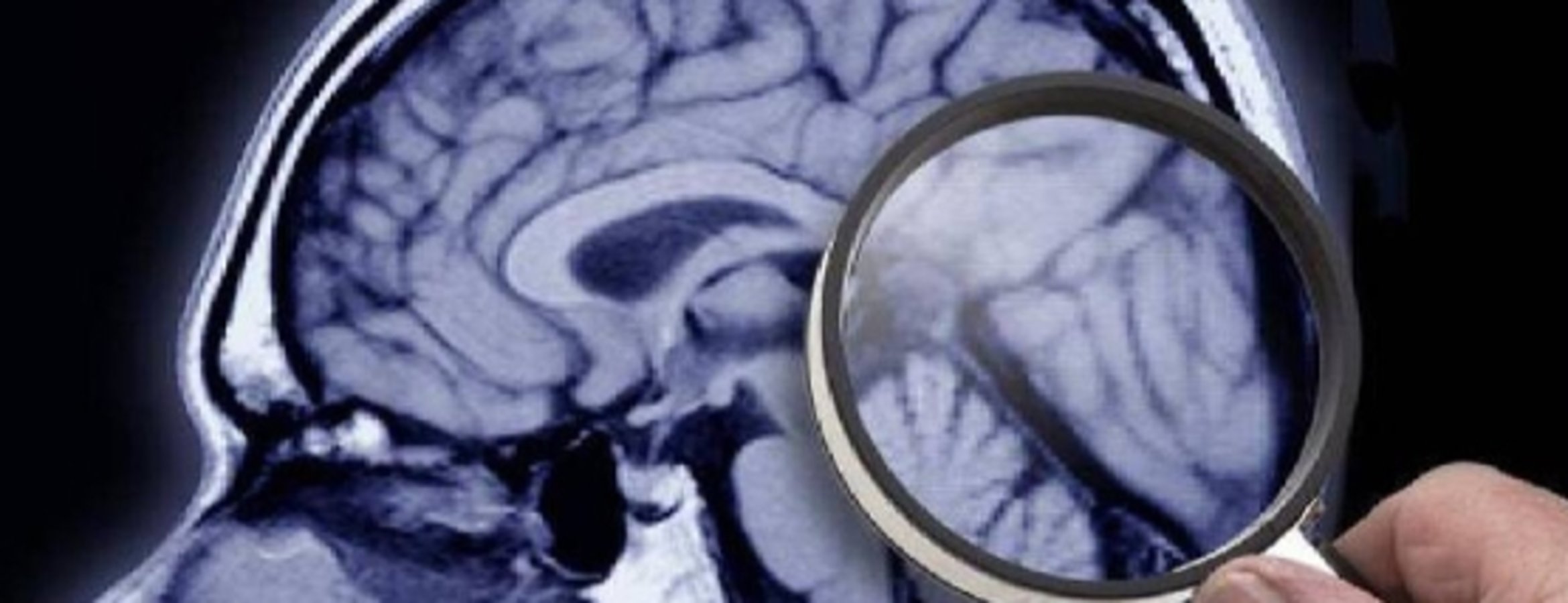 Araştırmalara göre, uykunun REM evresine geçişte zorlanmak Alzheimer belirtisi olabilir