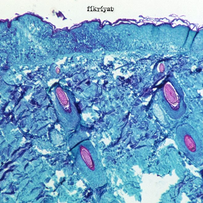 Maymun çiçeği virüsü Türkiye’de var mı?