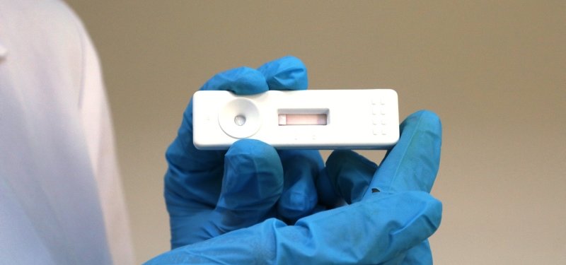 Turkish university develops 8-minute virus test kit